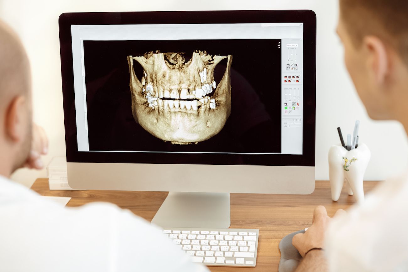 How Can I Regain Jawbone Structure Implant Dentistry In Hanover MD