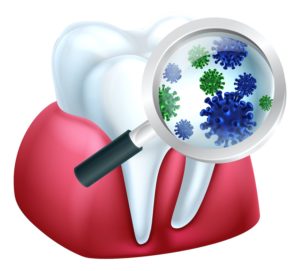 bacteria causes gum disease